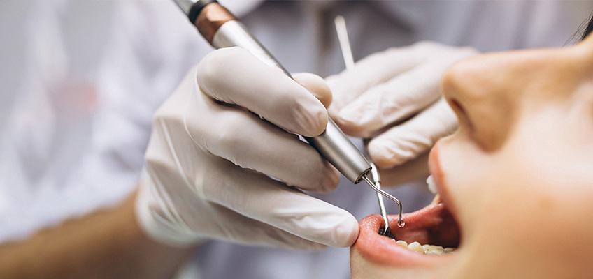 how-to-choose-the-right-dental-implant-specialist-for-your-full-mouth-reconstruction