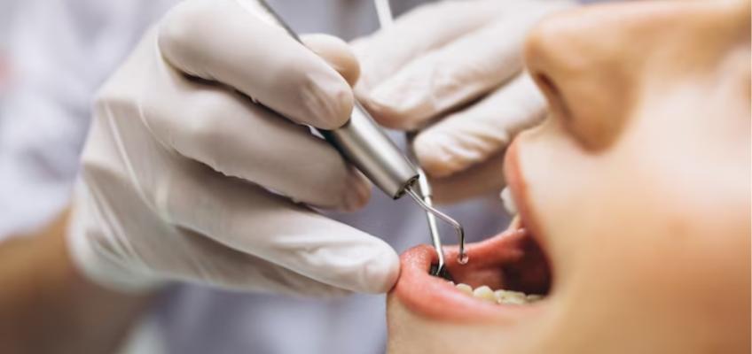 full-mouth-dental-implant-procedure