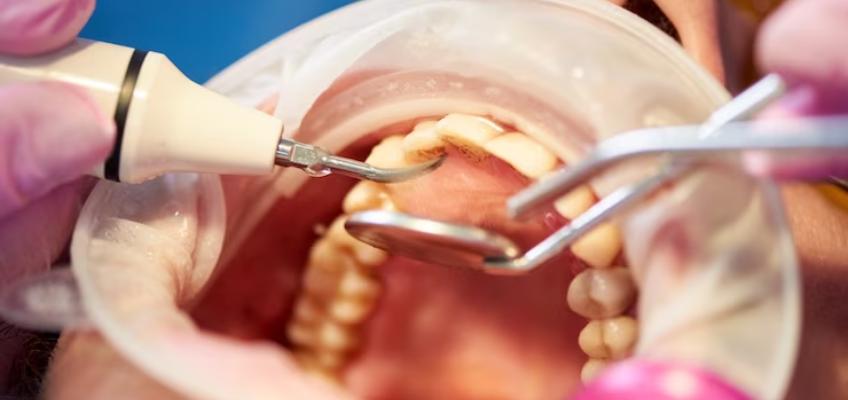 dental implant procedure