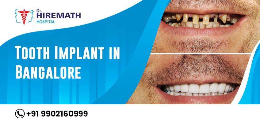 Criteria for getting endosteal dental implant