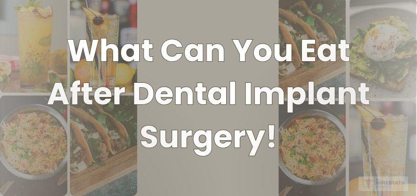 the-impact-of-dental-implants-on-your-diet-what-foods-to-eat-and-avoid