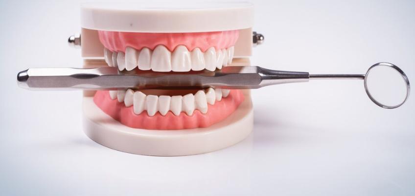 what are dental implants