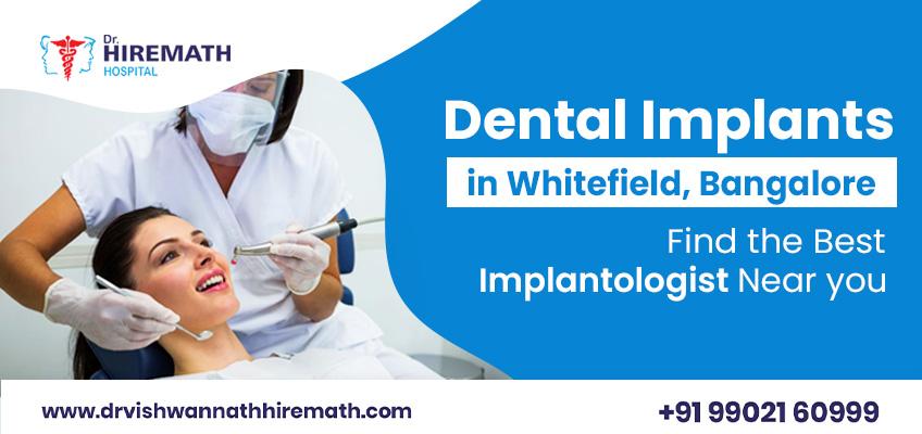 Criteria for getting endosteal dental implant
