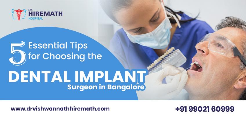 factors-for-choosing-the-best-dental-implant-surgeon-in-bangalore