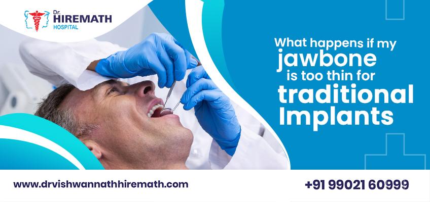 can-you-get-dental-implants-with-thin-jawbone