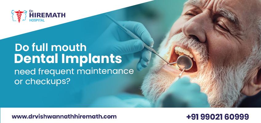 full-mouth-dental-implants-maintenance-checkups