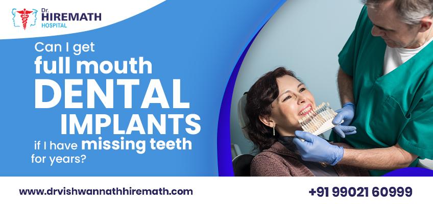 full-mouth-implants-after-years-of-missing-teeth