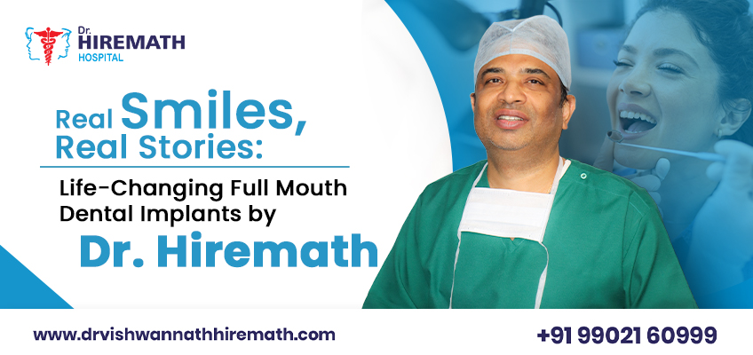 Life-Changing Full Mouth Dental Implants: Real Patient Testimonials by Dr. Vishwannath Hiremath, bangalore